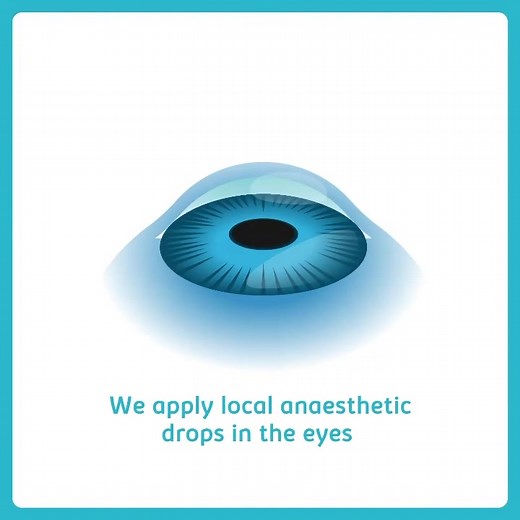 16 reactions | How is vision corrected during a Laser vision...