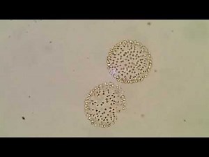 ウログレナ属の1種 Uroglena sp.