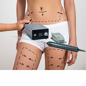 [Hot Item] Microaire PAL 650 Liposuction Unit