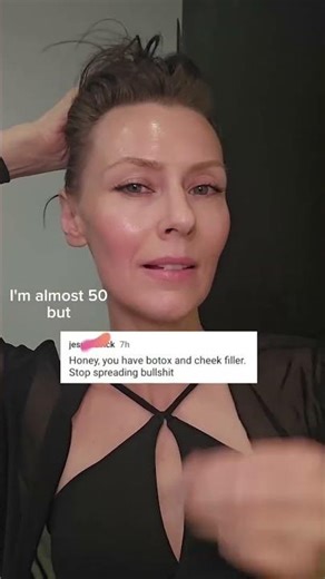 Botox-Free and Thriving