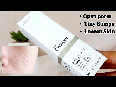 The Ordinary Niacinamide 10% + Zinc 1% Honest Review
