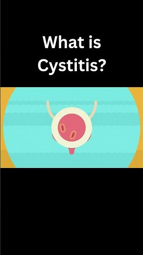 What is Cystitis?