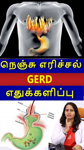 153K views · 1.4K reactions | நெஞ்செரிச்சல் (GERD) & எதுக்களிப்பு #gred #heartburn #heartburnrelief | A L Arogya spine and bone care center | Facebook