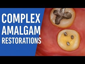 Advanced Dental Restorations: The Future of Tooth Repair