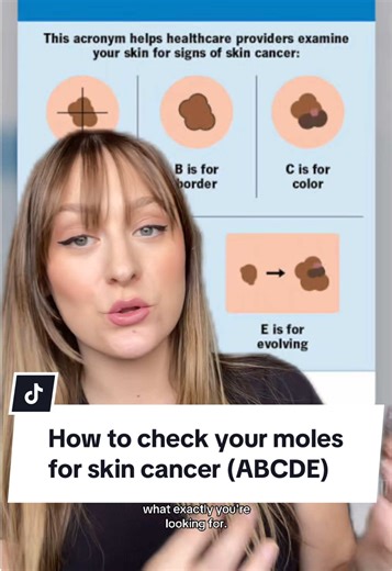 Have you checked your moles lately? Here is what the ABCDE check is looking for. While getting yearly checks is ideal, it’s still important to monitor your own health and see your doctor between appointments if you spot any warning signs! #melanoma #skinchecks #molecheck #skincancerawareness #melanomaawareness