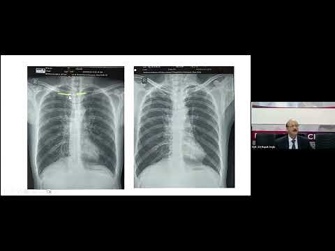 Learn to Read Chest X-Rays: A simple methodical Approach for Medical Practitioners
