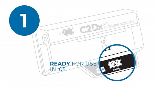 Measure Compartment Pressure - STIC (Quick Method) Instructions