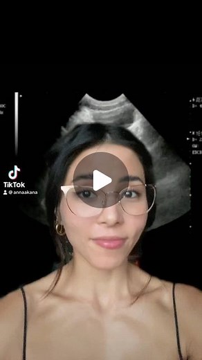 Anna Akana on Instagram: "My baby reveal 😭💕"
