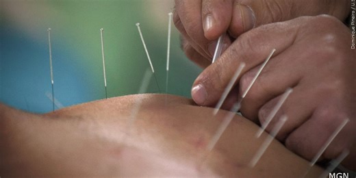 19 for a Cure: How acupuncture keeps you balanced and healthy