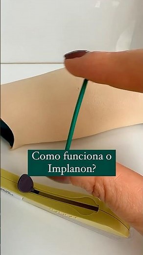 Como funciona o Implanon?