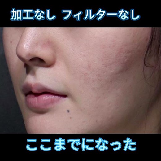 先端美容技術-プラズマエアシャワー美顔器 #美容 #スキンケア #DENSHINDO #Un #プラズマ美顔器 #プラズマ