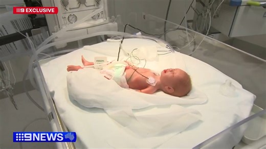 Meet George and Paul – no ordinary babies! As featured on Channel 9 News, these ultra-realistic baby mannequins are helping train our doctors and nurses to care for pre-term babies during their most critical first hour of life. 🍼 George mirrors a 29-week-old pre-term baby, complete with realistic weight, lung capacity, and skin that reseals for IV training. 🍼 Paul replicates a 27-week-old baby, with a detectable pulse, crying sounds, and even heart and bowel noises. These “simbabies” are now p