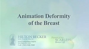 Animation Deformity (Patient Experience)