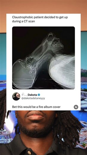 Claustrophobic patient decided to get up during a CT scan