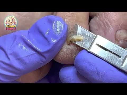 Amazing! Two extremely curly little inner armors