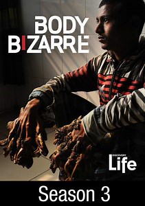 Body Bizarre: My Knees Bend Backward