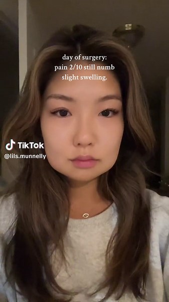 Wisdom Tooth Recovery: Healing Stages, Swelling, and Pain Relief