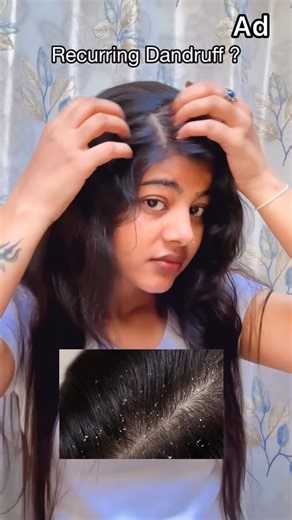 gitika sharma Makeup Artist/Travel & lifestyle on Instagram: "Tried everything for recurring dandruff? This time, treat it right. In just **2 weeks^**, our **clinically proven** Dandruff Treatment Serum reduces flakes, soothes irritation, and strengthens your scalp barrier—without any silicones, mineral oils, or synthetic additives. #ad #paidpartnership #FlakeFreeIn14Days #ScalpCare #DandruffTreatment #CleanBeauty"