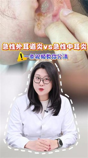 急性外耳道炎vs急性中耳炎，一条视频教你分清#急性外耳道炎 #急性中耳炎 #医学科普 #抖出健康知识宝藏 #耳朵发炎