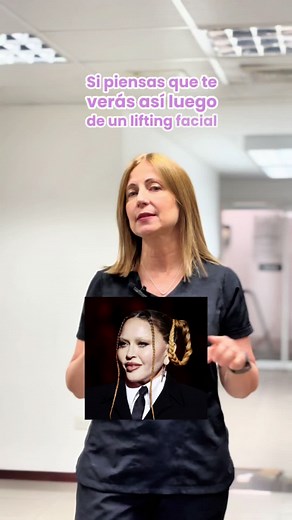 ¿Crees que un rejuvenecimiento facial significa pómulos inflamados y labios exagerados? ¡Eso sería un mal resultado 😲✨ La clave está en la naturalidad y armonía. Un lifting facial bien realizado te hará lucir fresca y radiante, no artificial. 🌟💖 Recuerda, el exceso de aplicación de rellenos o bioestimuladores pueden acumularse y provocar deformidades. Si buscas un cambio duradero y natural y tienes flacidez en la cara o cuello seguramente tienes la indicación de un refrescamiento facial con c