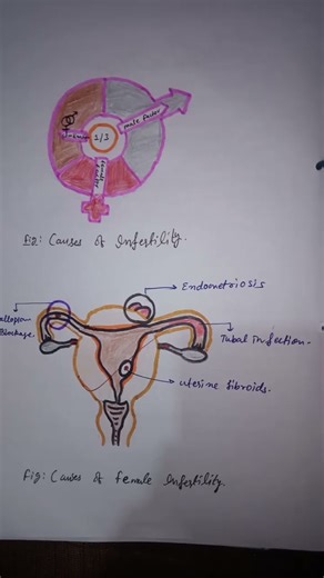 Class 12th Biology project file on INFERTILITY.