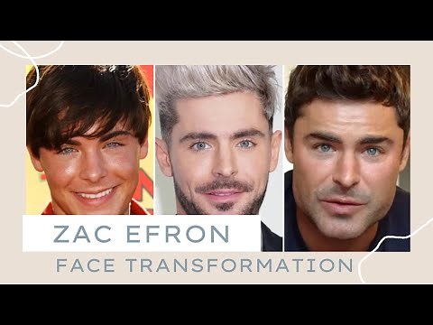 Zac Efron Face Transformation: Explained by a Plastic Surgeon