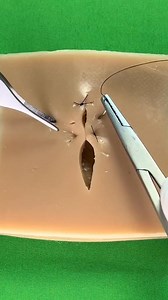 37K views · 357 reactions | Vertical mattress stitch | Dermhacks | Facebook