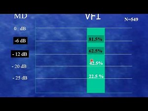 Field progression : which method to use? part 3 (Trend analysis)