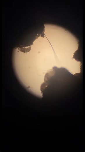 5.4K views · 26 reactions |  This morning our nurse Dara discovered...