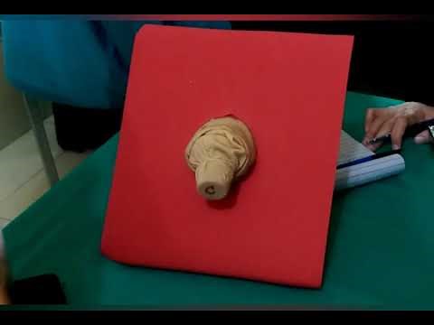 POP-Q Tutorial by Dr.Humera | #exam | #fcps | #osce | #prolapse | #clinical