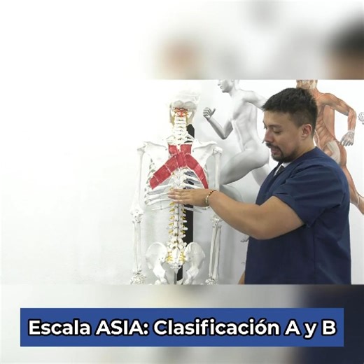 La escala de ASIA valora detalladamente el aspecto sensitivo, motor y los reflejos en un paciente con lesión medular, permitiendo identificar si es una lesión completa o incompleta, la escala tiene 5 clasificaciones, hoy te recordaremos la clasificación A y B.🤓🧠 #escaladeasia #neuro #neurologica #fisioterapianeurologica #fisio #reflejos #fisioterapiaenmovimiento #fisioterapia #fisioterapialapasionquenosune | Fisioterapia en Movimiento