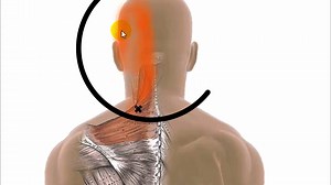 3.5K views · 98 reactions | Watch this video to learn about Trapezius...