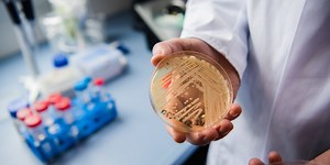 A deadly, drug-resistant fungus has swept the globe—here’s how it spreads