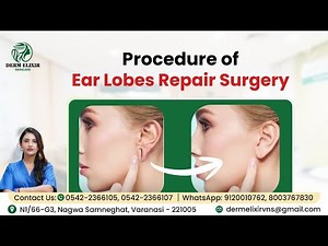 Torn Ear Lobe? Here’s How Ear Lobe Repair Surgery Works | Dr. Megha Pundir