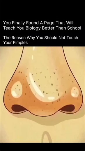 Explaining The Humans on Instagram: "When you squeeze or touch a pimple, you’re actually pushing the dirt, oil, and bacteria deeper into your skin. This leads to more swelling, redness, and painful inflammation. Not just that — popping pimples can tear your skin, causing dark spots, scars, and even infections that take weeks or months to heal. Touching your face also transfers new bacteria from your hands, making the breakout worse. So the next time a pimple appears, hands off! Let your skin hea