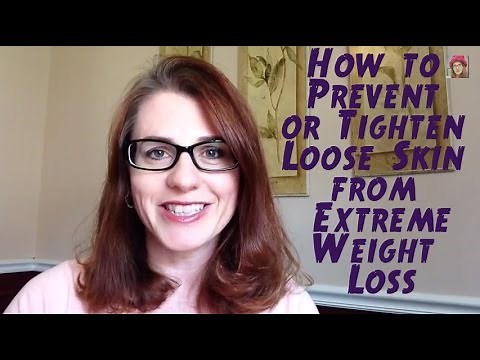 How to Prevent or Tighten Loose Skin from Weight Loss