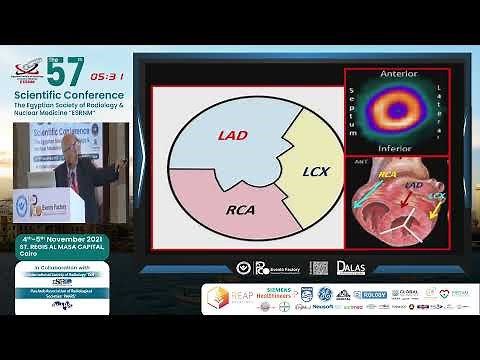 Myocardial Perfusion Scintigraphy