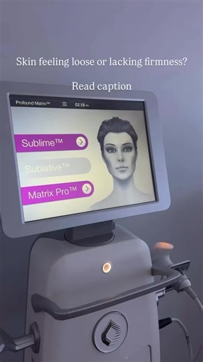 Infrared (IR) and radiofrequency (RF) combine in this Matrix treatment that is ideal for patients seeking immediate smoothing and skin tightening without downtime. The Sublime handpiece gently heats the dermis, triggering collagen production and deeper dermal remodeling for an effective non-invasive wrinkle treatment. 🎥 @bellapelle | Candela Medical