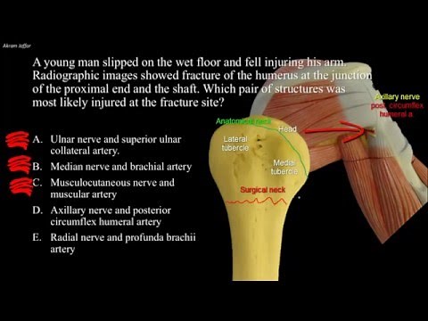 Fractures of the humeurs and possible nerve injuries