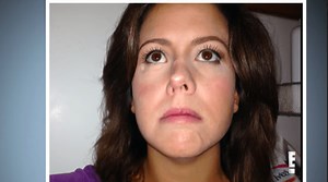 ‘Botched’ Season 5, Episode 16 Spoilers: The Doctors Make A House Call To Montana To Help A Patient After A Horrific Childhood Accident