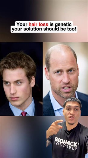 🎁 DNA test normally costs $250. Right now? FREE. Just pay $97 for your personalized hair formula. This test tells you if you're a Minoxidil non-responder, which DHT blockers work for YOUR genetics, and exactly what ingredients to use. ✅ DNA test: $0 (save $250) ✅ Custom topical: $97 ✅ Doctor-prescribed for you Limited time. No guessing. Just results. | Roots by Genetic Arts