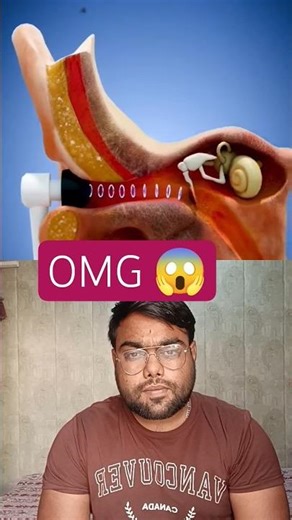 OMG age#shortvideo #facts #science #funny #ashortaday #amazingfacts #youtubeshorts #interestingfacts