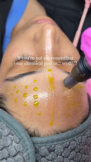 The Skin Games | Skincare | ✨ Reposting this gorgeous process from @mh.estheticsss using BioRePeel from @bioskin_aesthetics_inc — because THIS is how to get the glow... | Instagram
