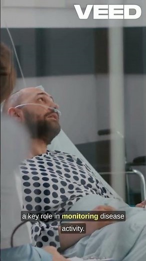 Decoding the Anti dsDNA Test for SLE