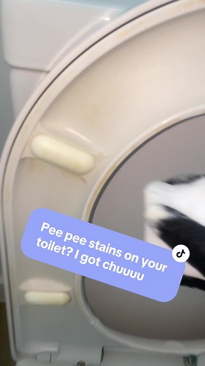 How to Remove Yellow Stains from Toilet Seat
