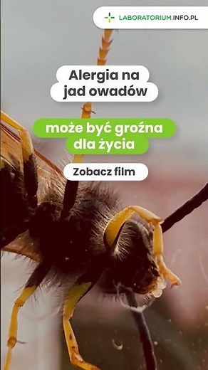 Alergia na jad owadów może być groźna dla życia