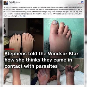 34K views · 213 reactions | Dozens of parasitic worms were found...