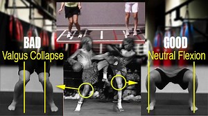 Valgus Knees: Corrective Strength and Conditioning Exercises