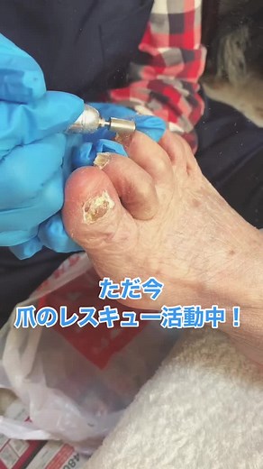 #肥厚爪ケア #高齢者の爪トラブル #爪のレスキュー活動中#爪の悩み #1日で学べるよ #福祉爪ケア普及協会 #介護ネイル #福祉ネイル #肥厚爪削り #爪肥厚 #介護施設#特別養護老人ホーム #デイサービス #介護#高齢者施設 #爪 #DoritoslaÇıtırdatanLezzetler