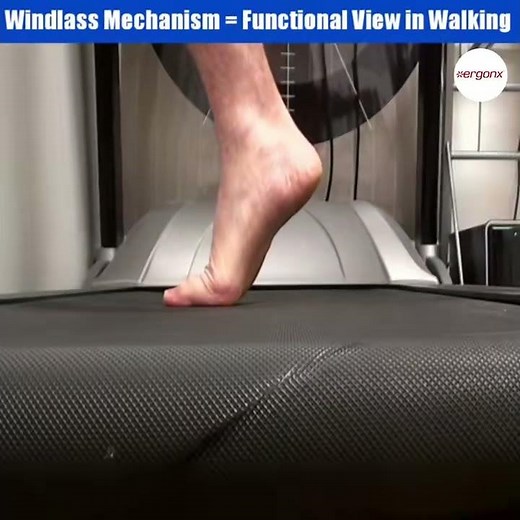 The Windlass mechanism in the foot adds stability and promotes pain-free walking when the foot is su